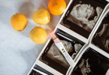 8 Tips for Preventing Infections Before & During Pregnancy