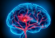 Being a Health Advocate: A Stroke Survivor Story by Alyson McCord